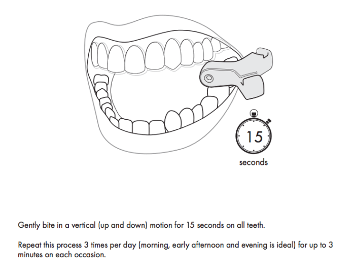 Instructions for Munchies device for clear aligners