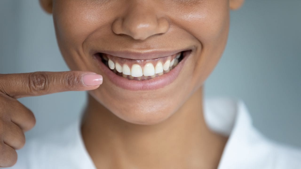 Multiple teeth Implants in Hunt Valley, MD