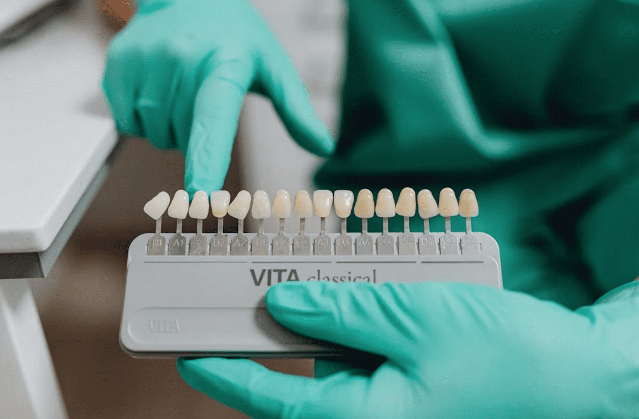 Porcelain veneers for teeth whitening